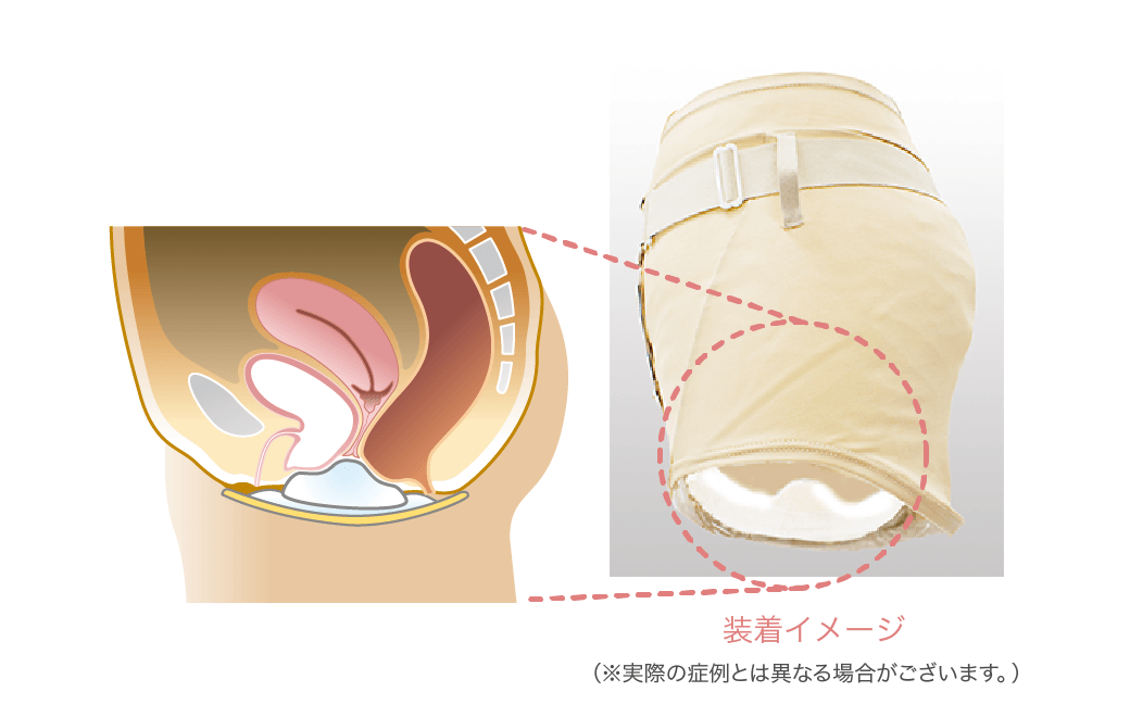 装着イメージ
